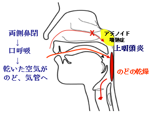 鼻呼吸の大切さ 山口内科耳鼻咽喉科